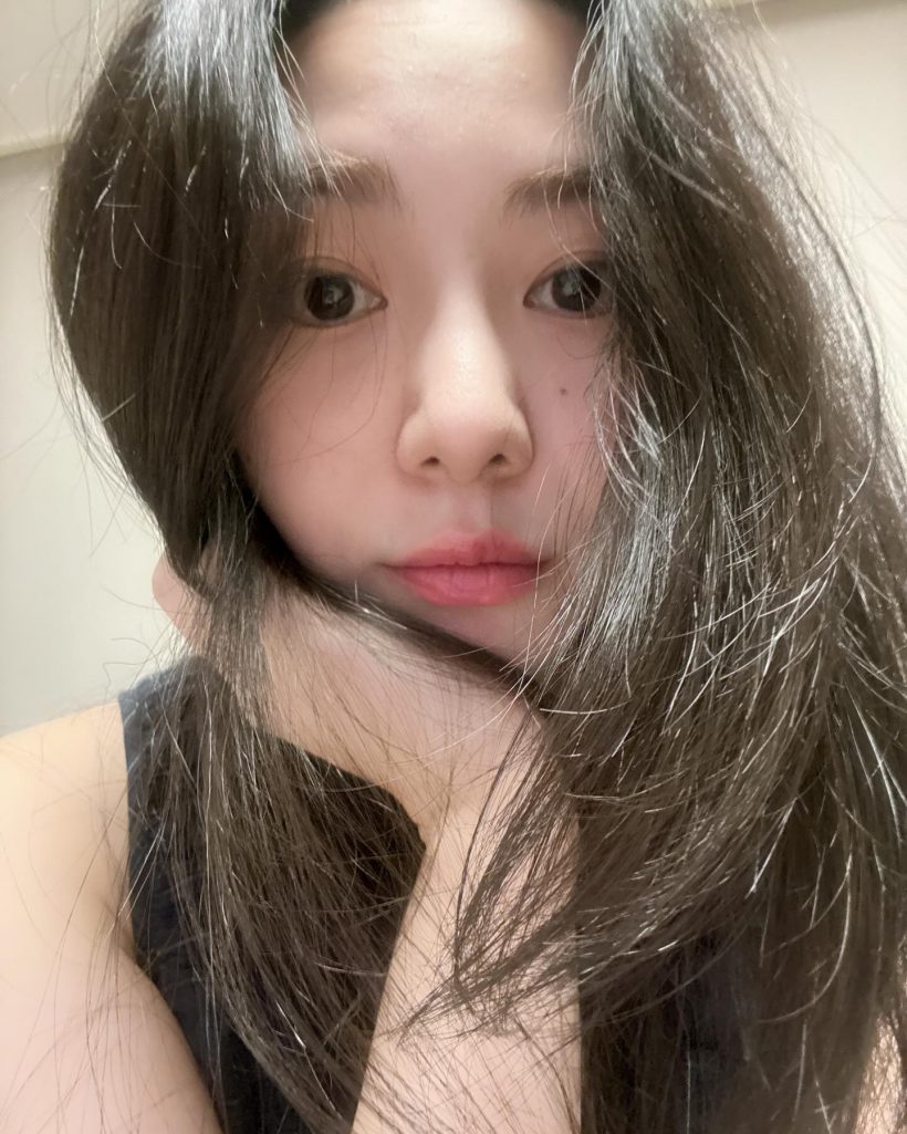 ดาราสาว เผยรอยแผลหน้าเสียโฉม ไม่ท้อสมัครงานหาเงินรักษา