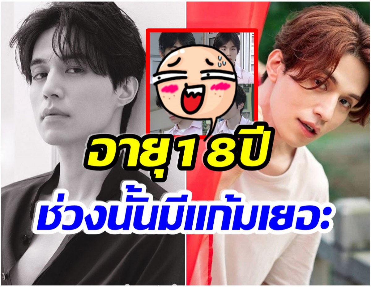 หน้าละอ่อน! เปิดภาพ ดงอุคโอปป้า ในวัย 18ปี เเก้มเยอะมาก