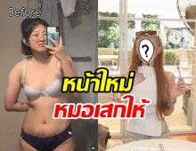 ทายาทนางเอกดังตอบไม่กั๊ก! หน้านี้สวยจริงเพราะมีดหมอ