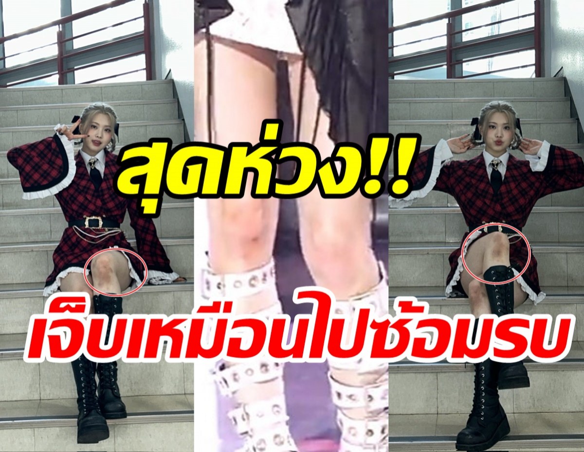  แฟนคลับสุดห่วงPurple K!ssเต้นจนเข่าช้ำ จี้ต้นสังกัดปกป้องศิลปินด่วน