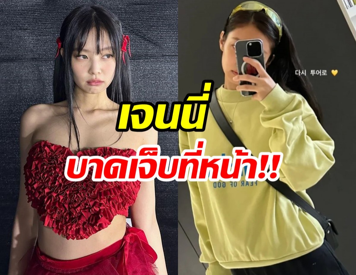 แห่เป็นห่วง! เจนนี่ BLACKPINK บาดเจ็บที่หน้าตอนออกกำลังกาย