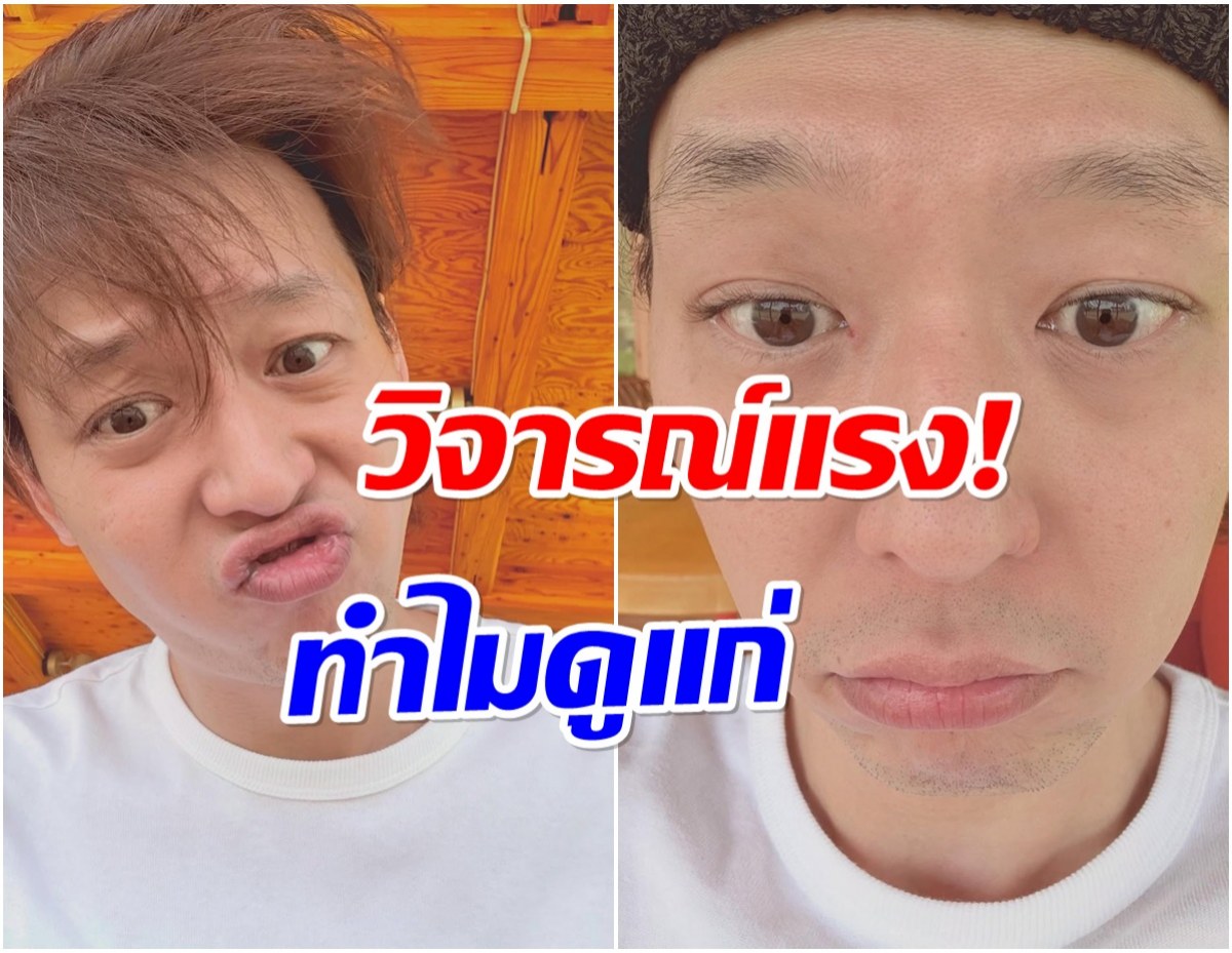 อดีตศิลปินอัปเดตภาพล่าสุด เเต่เจอวิจารณ์เเรงหน้าเปลี่ยนไปมาก