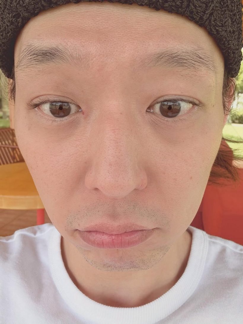 อดีตศิลปินอัปเดตภาพล่าสุด เเต่เจอวิจารณ์เเรงหน้าเปลี่ยนไปมาก