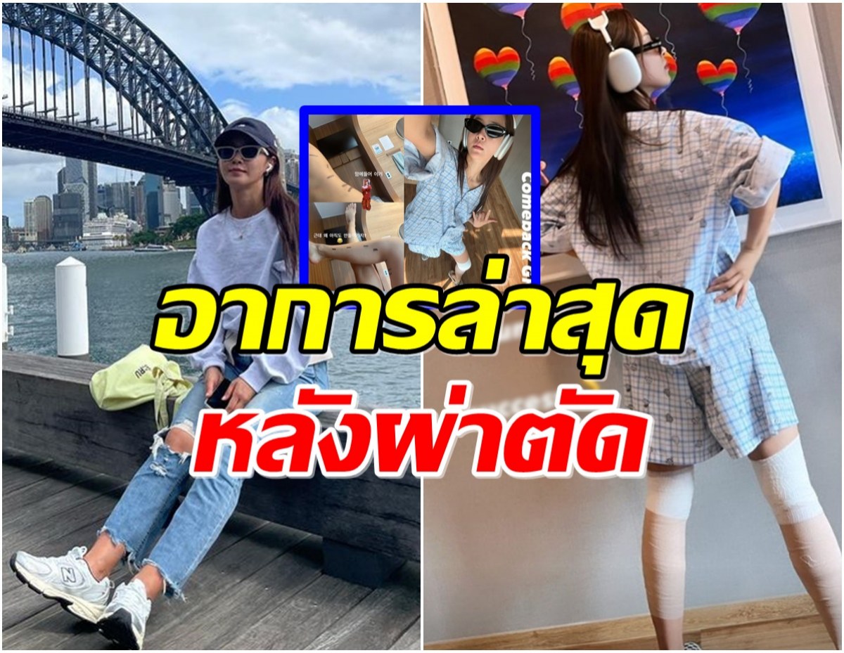 ไม่เจ็บอีกเเล้ว! ซุปตาร์สาวอัปเดตล่าสุด หลังเข้ารับการผ่าตัด