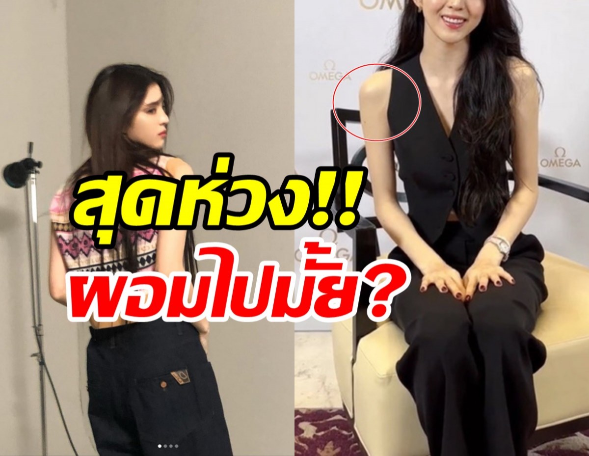 แฟนๆ เป็นห่วง ซุปตาร์สาวออกสื่อล่าสุดดูซูบผอมแขนขาเล็กไปหมด