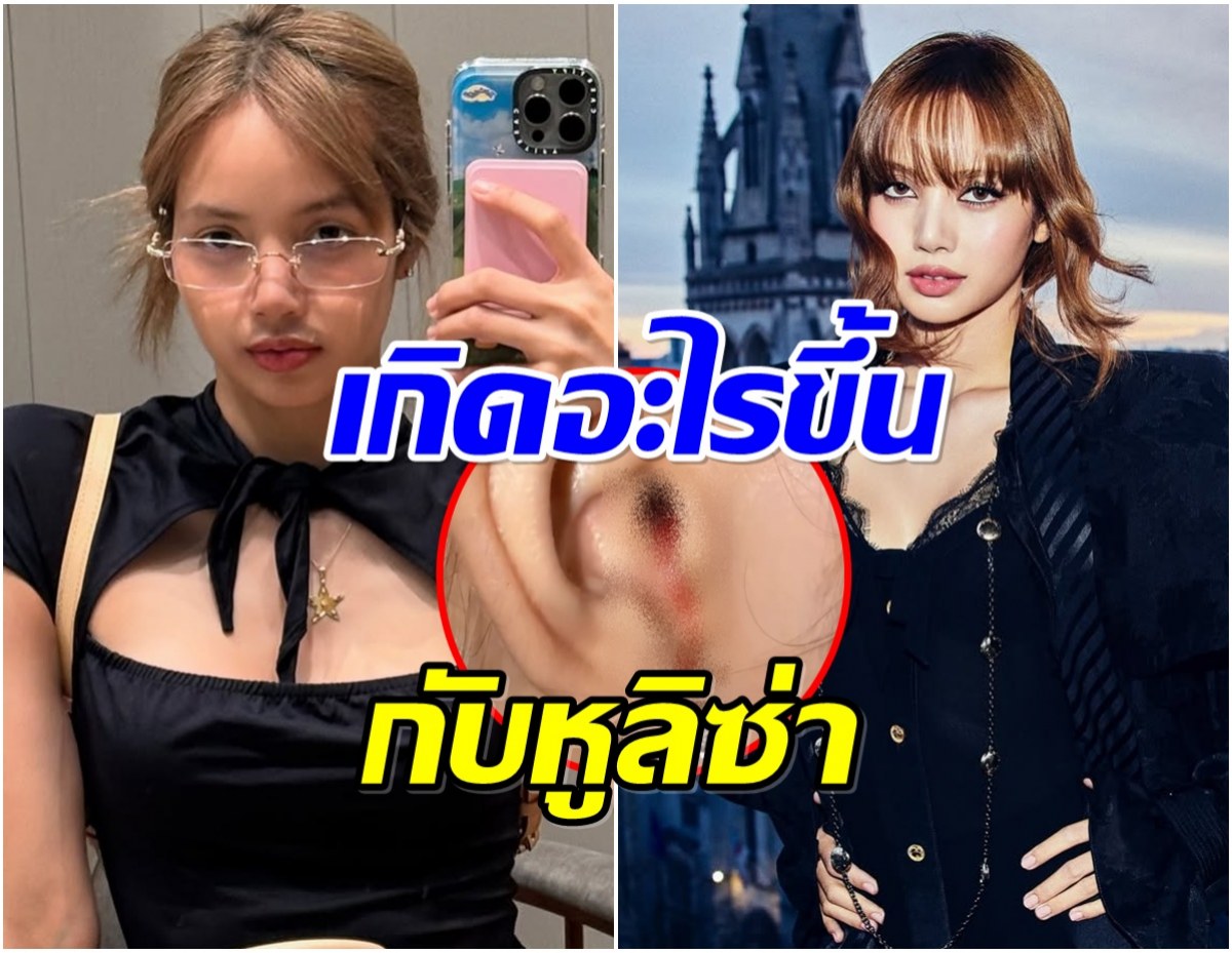 ลิซ่า ทำเเฟนๆเป็นห่วง คลิปเลือดออกหู เเห่ถามเกิดอะไรขึ้น?