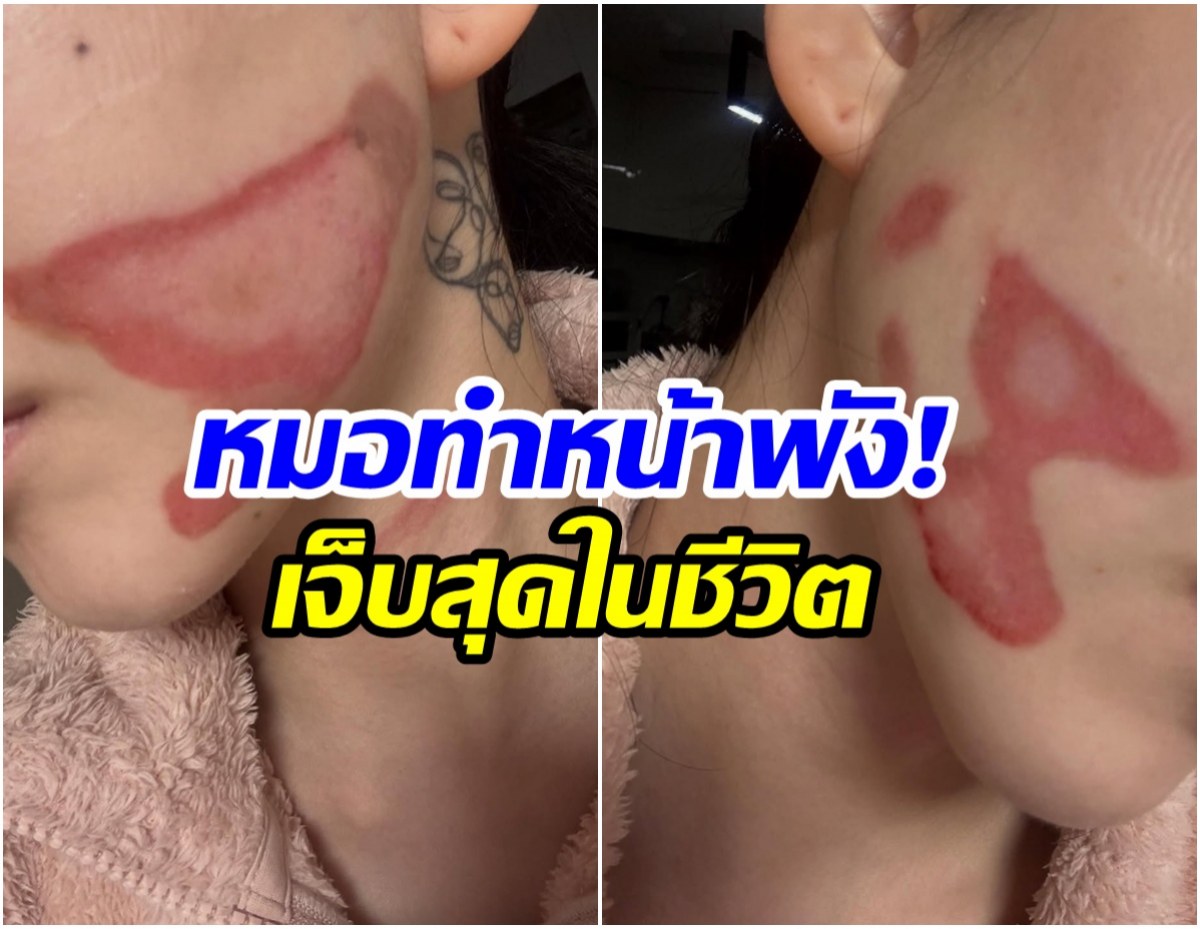 ใจสลาย! ศิลปินสาวเล่าทั้งน้ำตา อยากสวยเเต่หมอทำหน้าพัง!