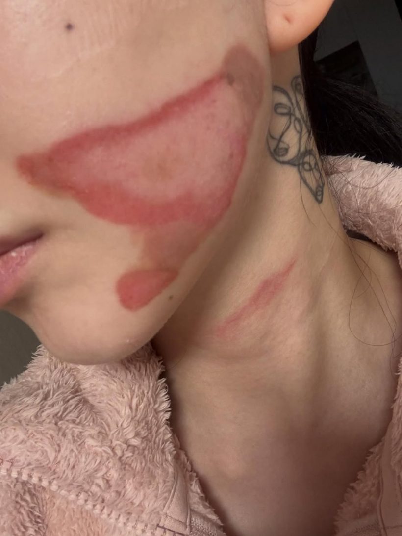 ใจสลาย! ศิลปินสาวเล่าทั้งน้ำตา อยากสวยเเต่หมอทำหน้าพัง!