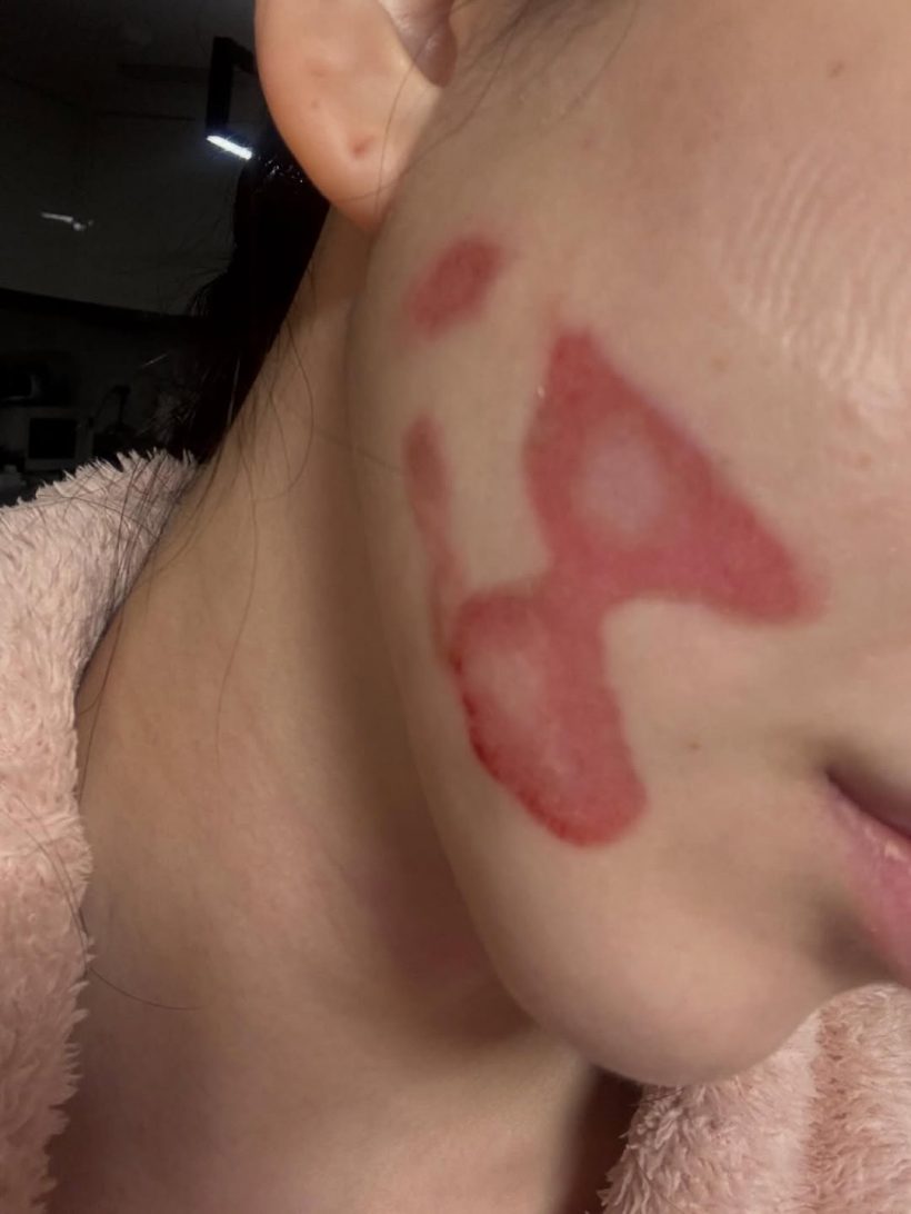 ใจสลาย! ศิลปินสาวเล่าทั้งน้ำตา อยากสวยเเต่หมอทำหน้าพัง!