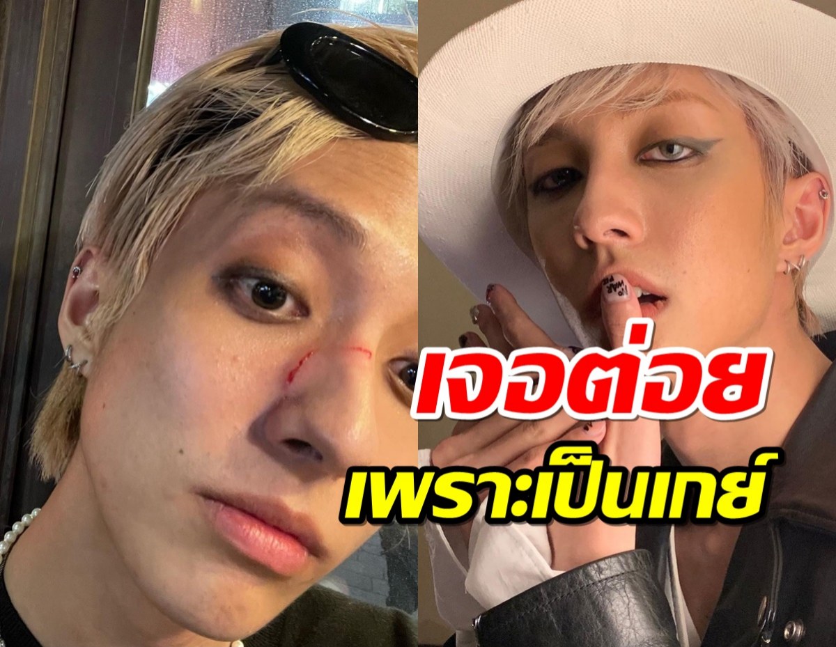 ไอดอลเกย์คนแรกของเกาหลี ถูกทําร้ายจากพวกเหยียดLGBTQ