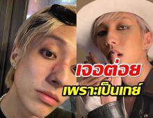 ไอดอลเกย์คนแรกของเกาหลี ถูกทําร้ายจากพวกเหยียดLGBTQ