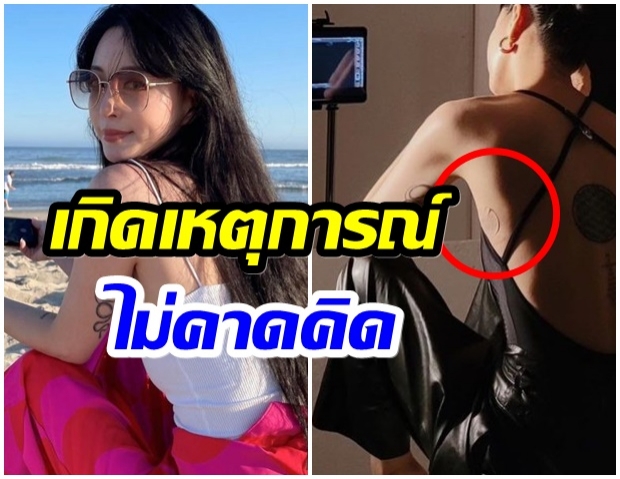 เเห่ส่งกำลังใจหลัง นักเเสดงสาว มีรอยเเผลเป็นที่เกิดจากการผ่าตัดผิดพลาด