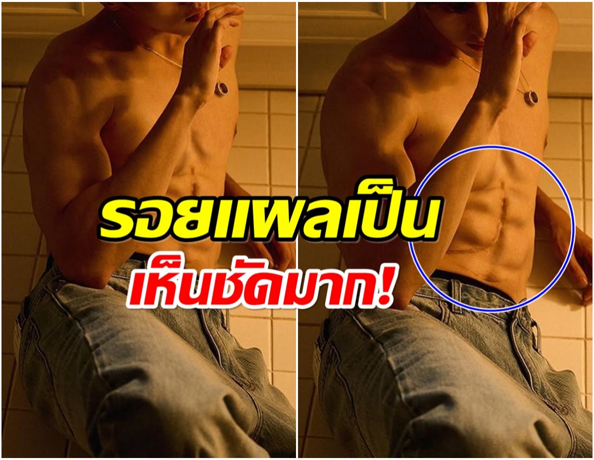 สุดยอดลูกกตัญญู! นักเเสดงหนุ่ม เคยบริจาคตับ เพื่อช่วยแม่รอดชีวิต