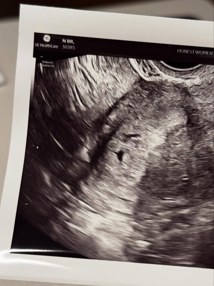 นางเอกดัง ทำเซอร์ไพรส์! เพิ่งเเต่งไม่นานข่าวดีท้องเเล้ว