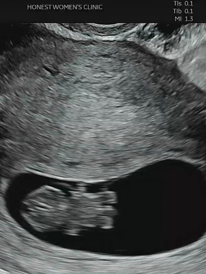 นางเอกดัง ทำเซอร์ไพรส์! เพิ่งเเต่งไม่นานข่าวดีท้องเเล้ว