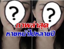 โพสต์ล่าสุด นักเเสดงสาวคนดัง ทำเเฟนๆห่วงเพราะปัญหาสุขภาพ