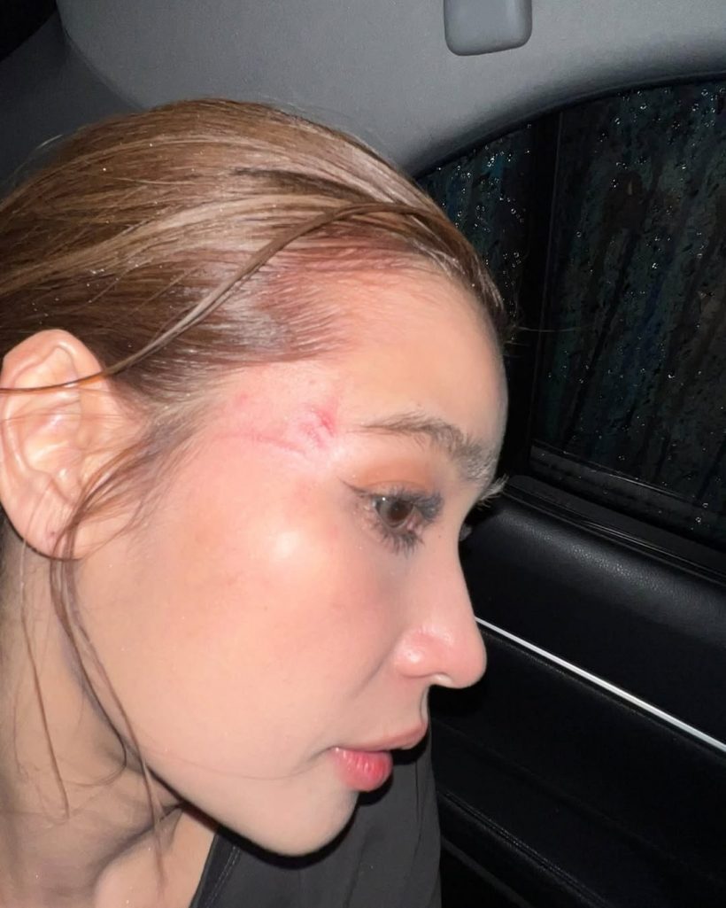 วิว วรรณรท ไม่ห่วงสวย ละครเรื่องใหม่ ยอมเจ็บจริง!