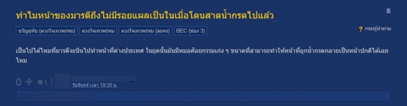 ขวัญฤทัย โดนจับผิดแล้ว แผลเป็นที่หน้ามารตี หายไปไหน?