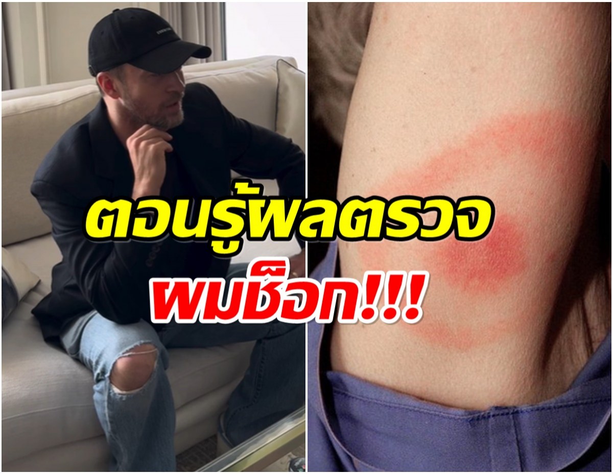 เเฟนๆส่งกำลังใจ! นักร้องหนุ่มเเจ้งข่าวร้าย ป่วยโรคไลม์