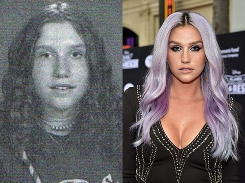 KESHA