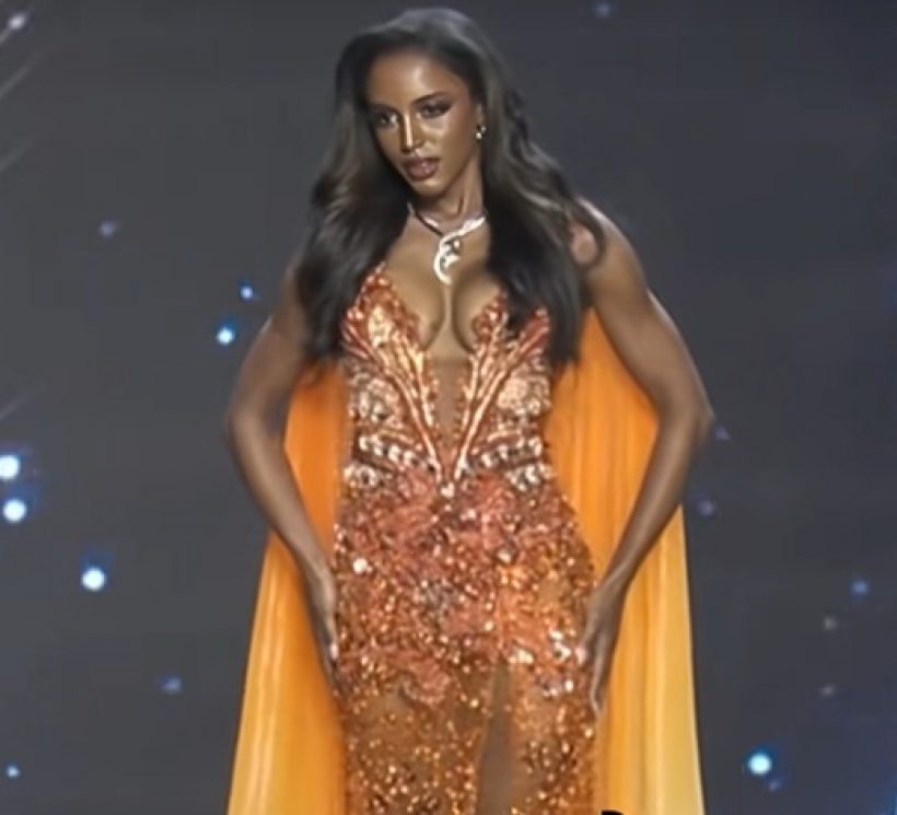 อัปเดตอาการล่าสุด มิสจาเมกา ตกเวทีมิสยูนิเวิร์ส 2025