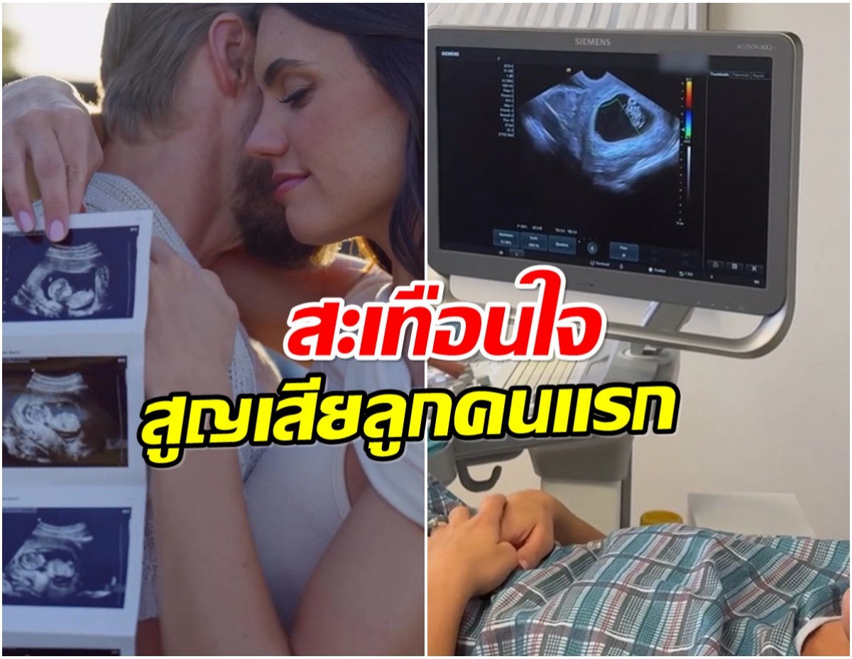 คู่รักดังโพสต์คลิปทำน้ำตาซึม เผยความรู้สึกสูญเสียลูกคนเเรก
