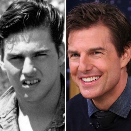 ทอม ครูซ (Tom Cruise)