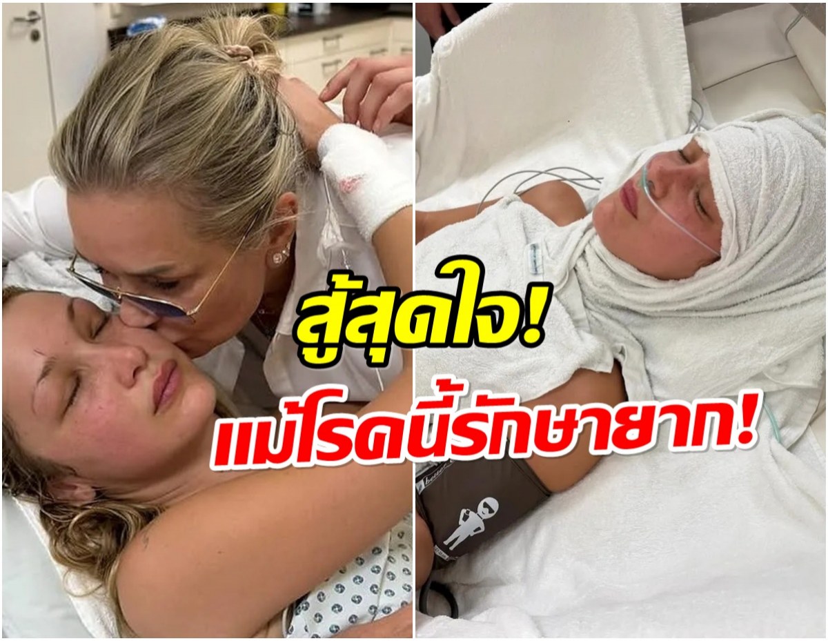 คุณเเม่เผยภาพนางเเบบดัง ต่อสู้โรคร้ายยาวนาน 10 ปี