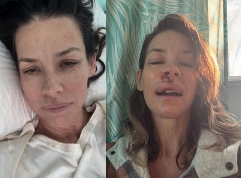 วูบกลางหาด! นักเเสดงสาว หน้าฟาดหิน แผลชัดจนแฟนตกใจ