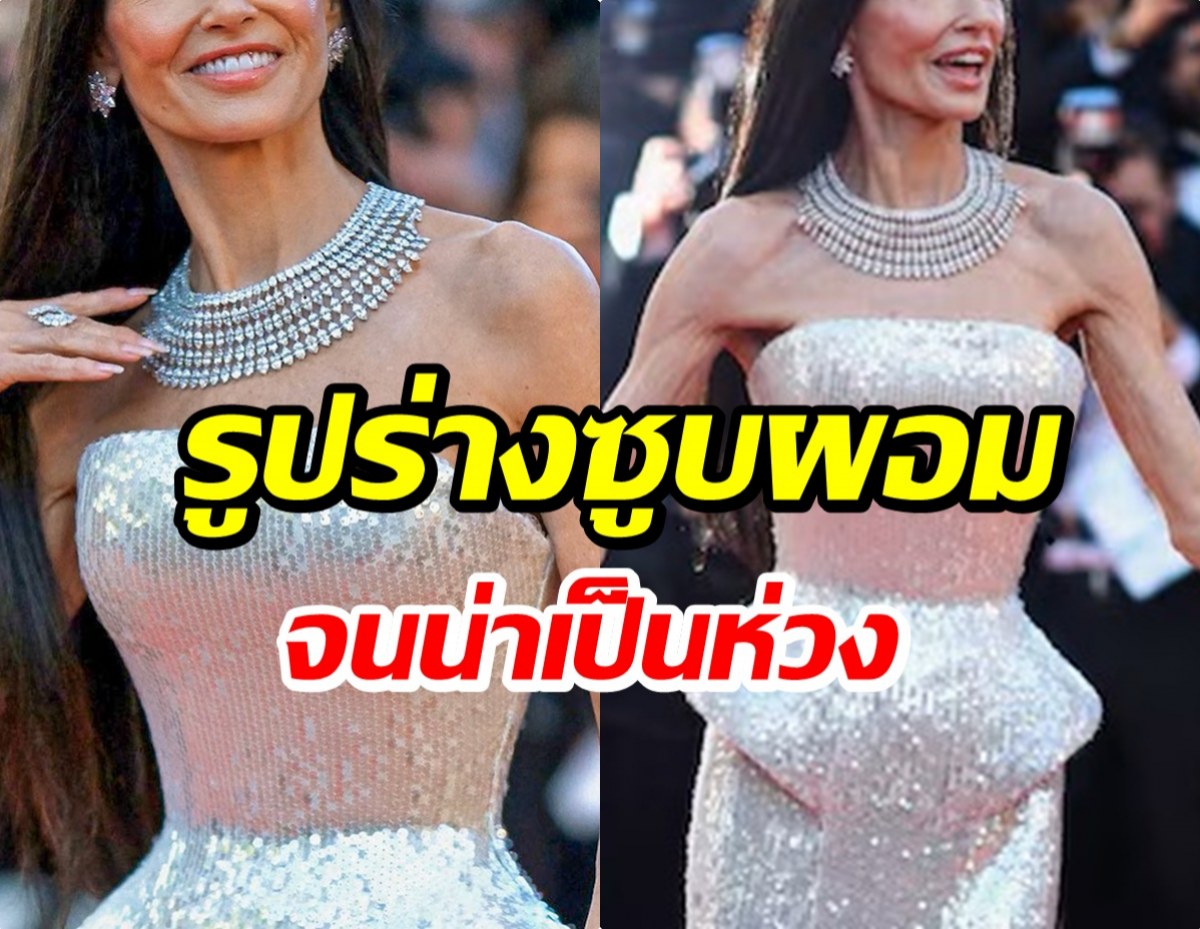 ชาวเน็ตตกใจภาพล่าสุด ซุปตาร์ตัวเเม่ ทำไมผอมลงขนาดนี้!