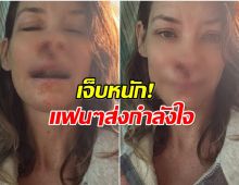 วูบกลางหาด! นักเเสดงสาว หน้าฟาดหิน แผลชัดจนแฟนตกใจ