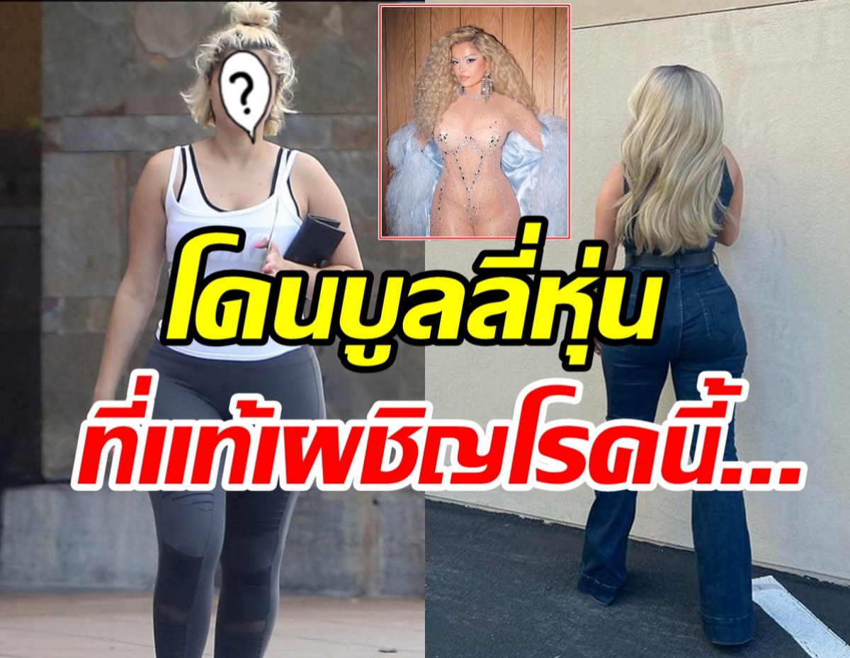 ซุปตาร์สาวถูกโซเชียลวิจารณ์อ้วนขึ้น หลายคนอาจไม่รู้เธอป่วยโรคนี้