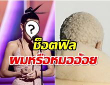 ซุปตาร์สาวอารมณ์เสียกลางไลฟ์ โดนเเซวเเรง! นั่นผมหรือหมออ้อย! 