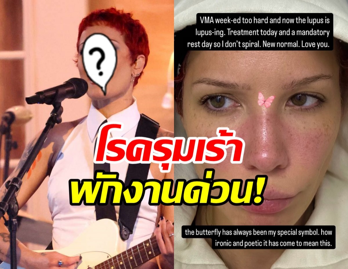 ส่งกำลังใจนักร้องสาวโรคลูปัสกำเริบ ต้องพักงานด่วน!