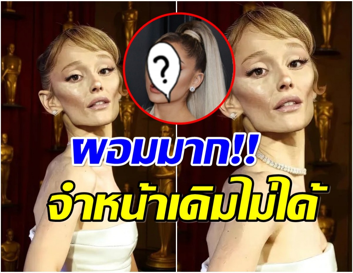 เเฟนๆตกใจ! ภาพล่าสุดซุปตาร์สาว ผอมลงมากเหมือนไม่ใช่คนเดิม