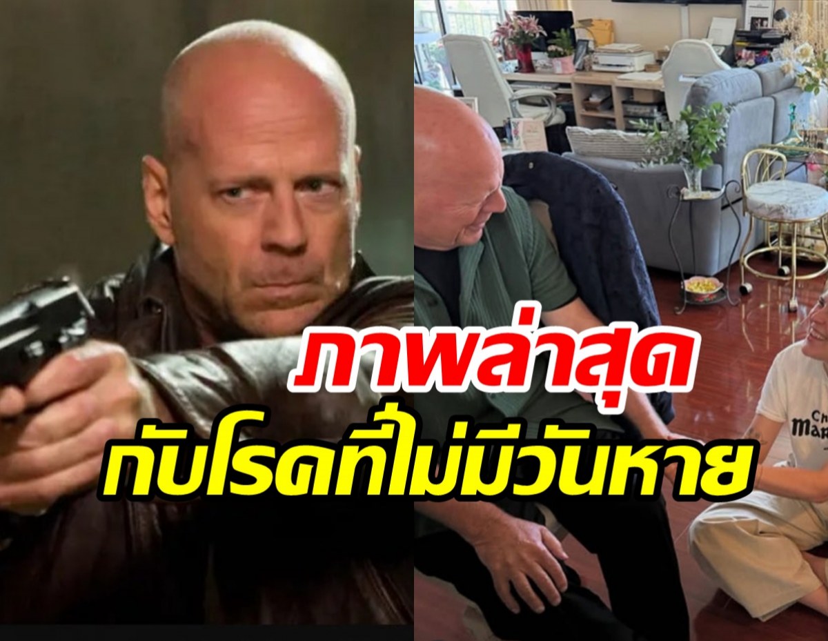 ภาพล่าสุดซุปตาร์โลก บรูซ วิลลิส ป่วยหนัก อาการทรุด