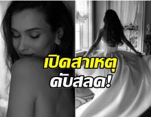 สะเทือนวงการ! นางงามดัง เสียชีวิต หลังสมองบาดเจ็บโคม่านับเดือน