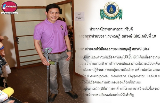 ร.พ.รามาฯ ออกแถลงการณ์อาการ ปอ ทฤษฎี ฉบับที่ 10