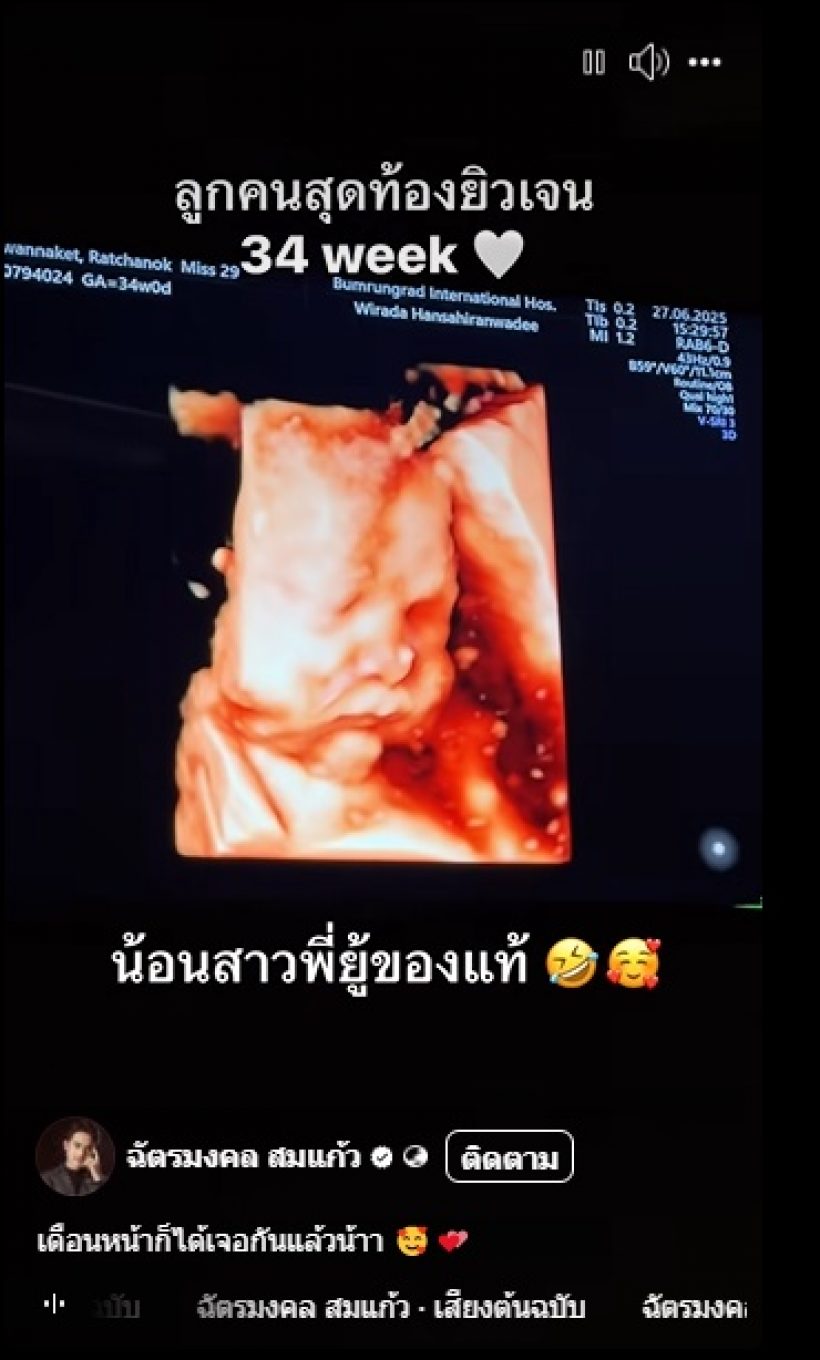 เฮสนั่น ดาราสาวชื่อดัง นับถอยหลังคลอดลูกสาวคนที่2