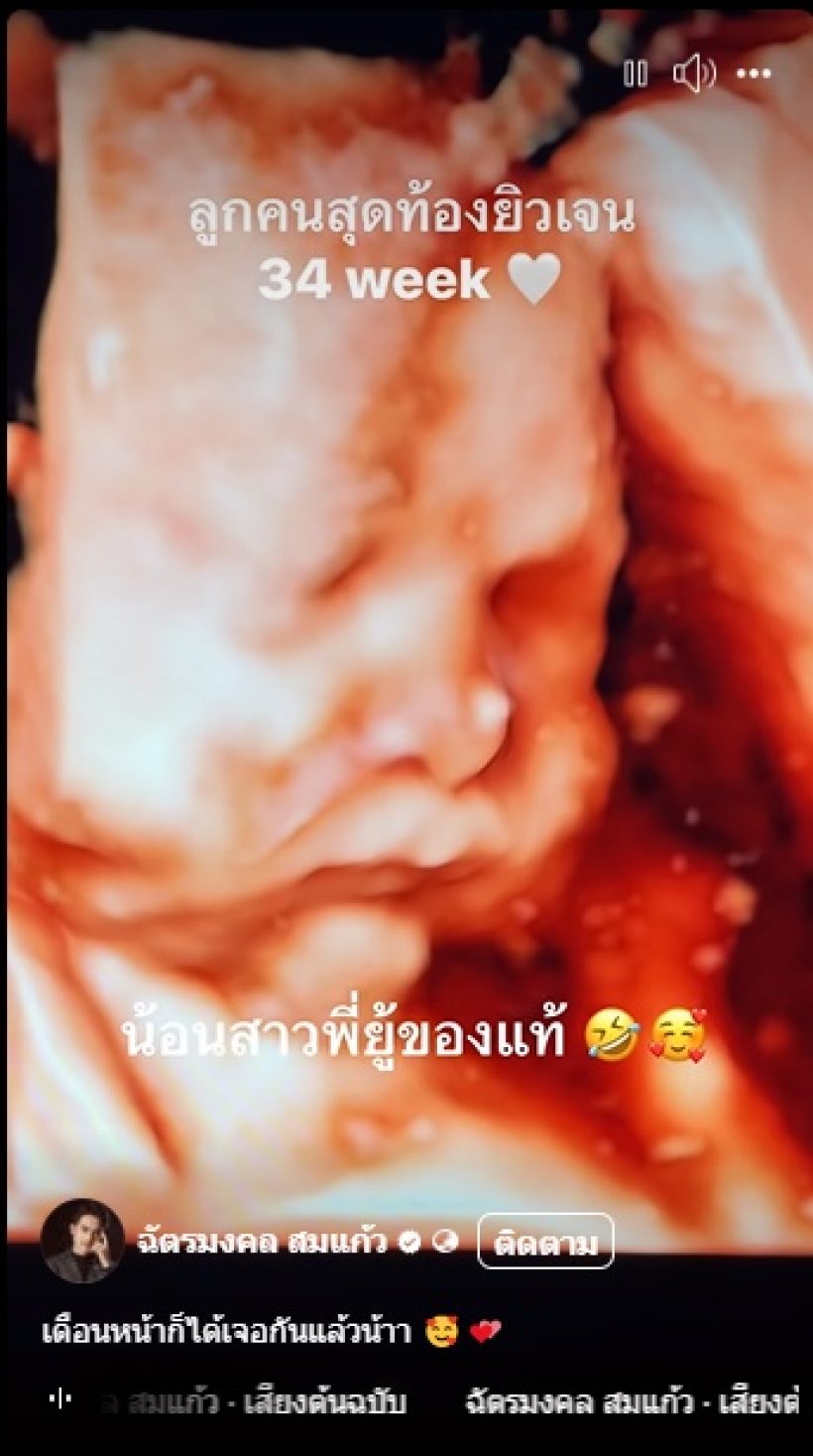 เฮสนั่น ดาราสาวชื่อดัง นับถอยหลังคลอดลูกสาวคนที่2