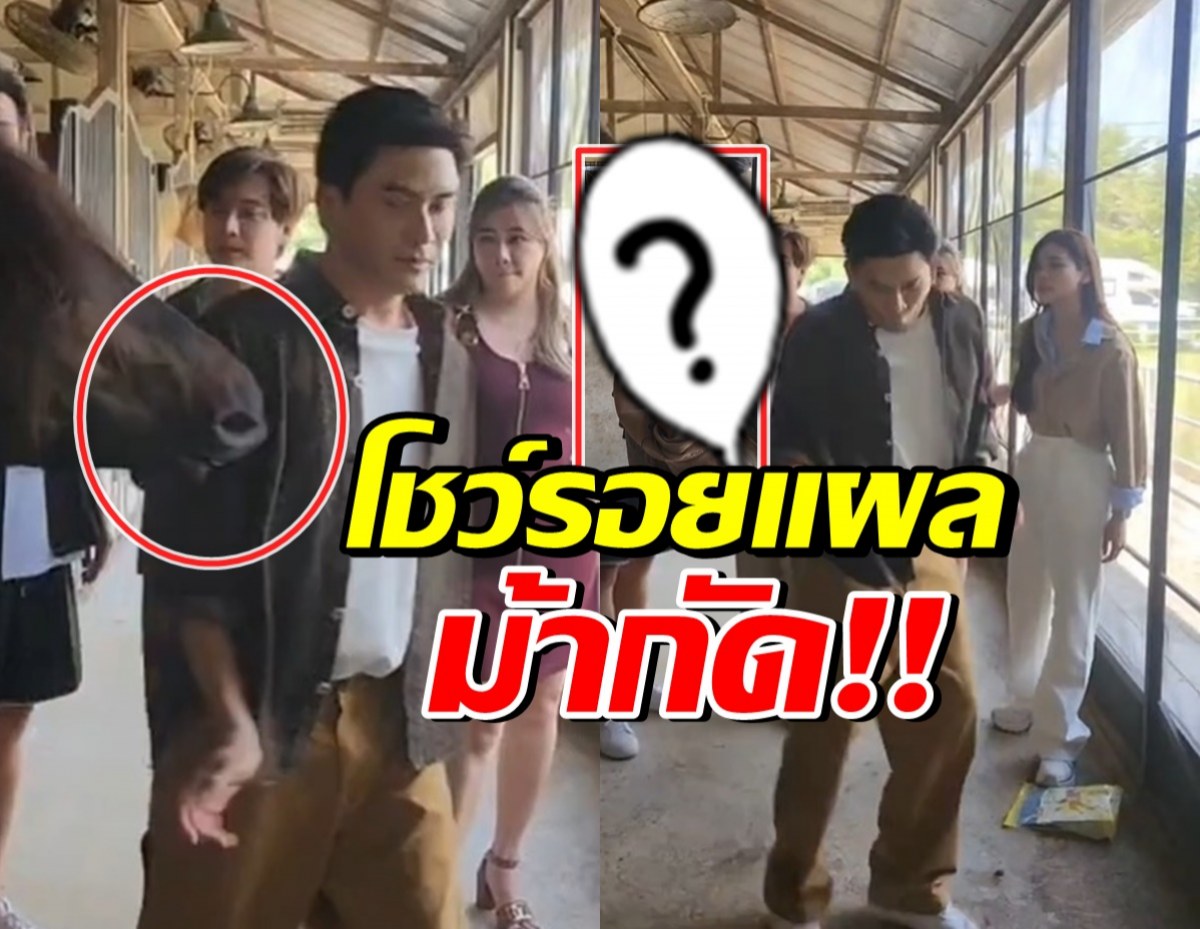 เห็นแล้วตกใจ! เปิดแผล ป๋อ ณัฐวุฒิ โดนม้ากัดกลางรายการ