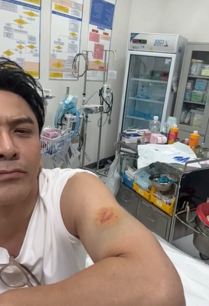 เห็นแล้วตกใจ! เปิดแผล ป๋อ ณัฐวุฒิ โดนม้ากัดกลางรายการ