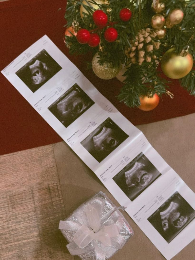 ดาราสาวดังท้องแล้ว เปลี่ยนใจ อยากมีลูกตั้งแต่เมื่อไหร่!?