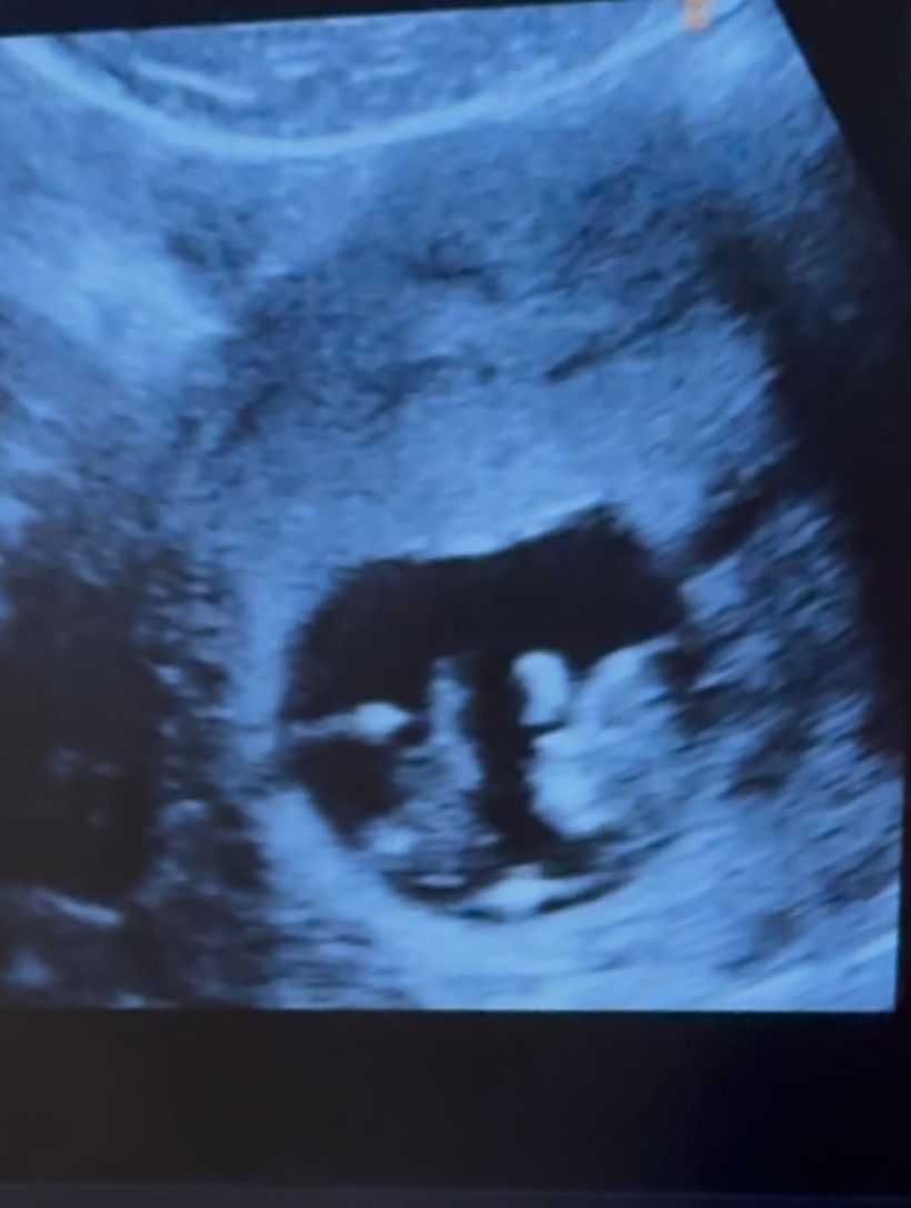 ดาราสาวดังท้องแล้ว เปลี่ยนใจ อยากมีลูกตั้งแต่เมื่อไหร่!?