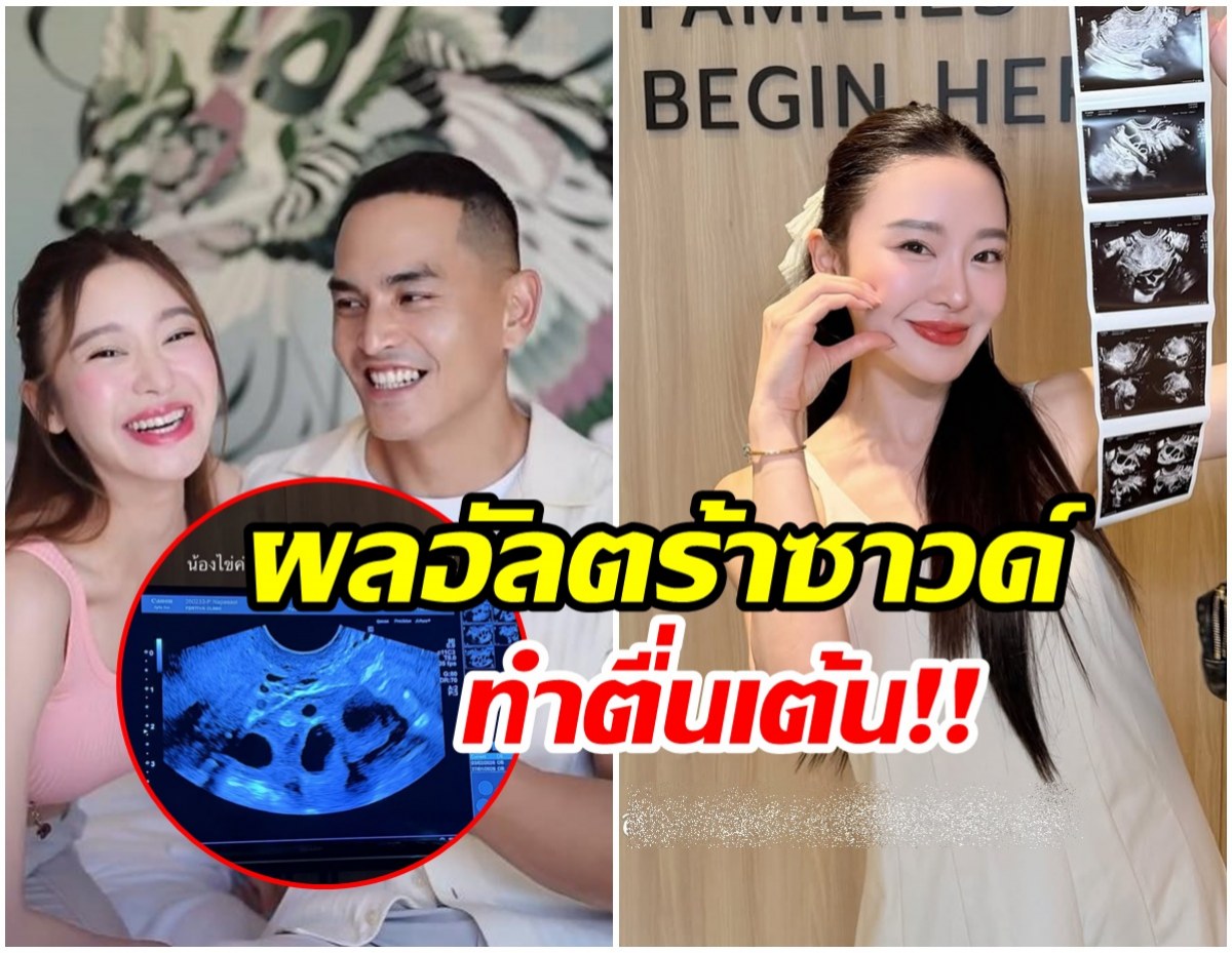 มายด์ ณภศศิ ประกาศข่าวดีลงไอจี งานนี้ตื่นเต้นสุดๆ