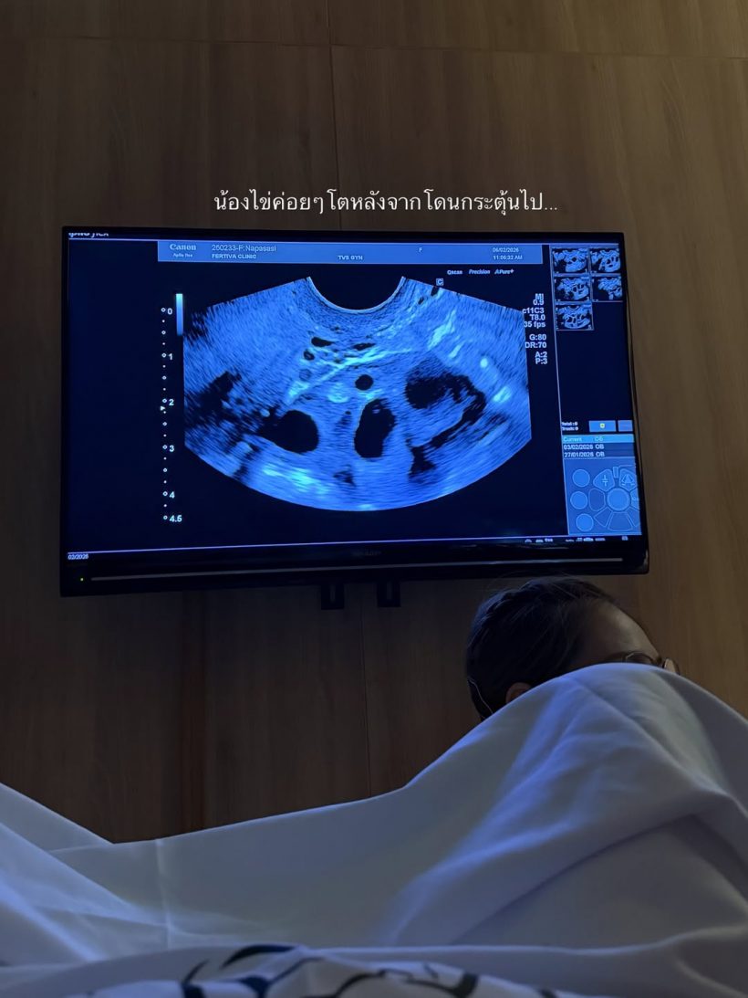 มายด์ ณภศศิ ประกาศข่าวดีลงไอจี งานนี้ตื่นเต้นสุดๆ