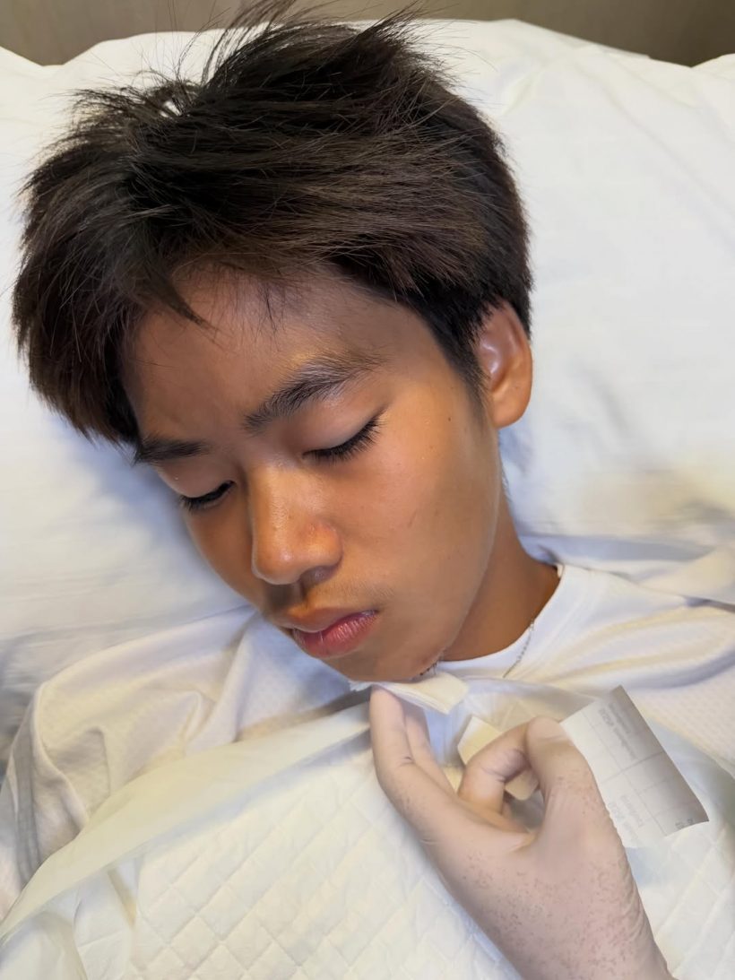 สปิริตสุดยอด! น้องออก้า คางแตกแต่ใจสู้แข่งเจ็ตสกีต่อ