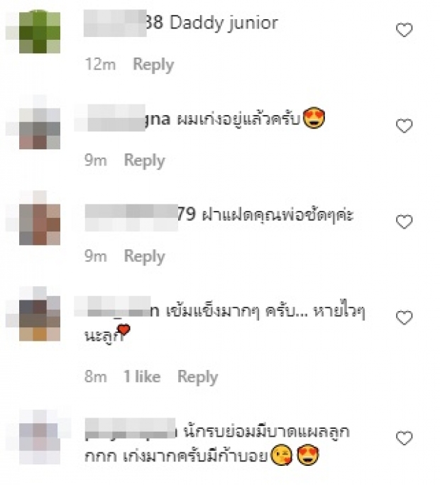 แฟนๆ สุดสงสาร น้องมีก้า ล้มคะมำ หน้าช้ำไปหมด