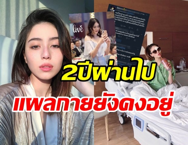 เปิดภาพชัดๆ รอยแผลบนตัว มิล่า 2 ปีผ่านไป ยังคงไม่เลือนลางจางหาย