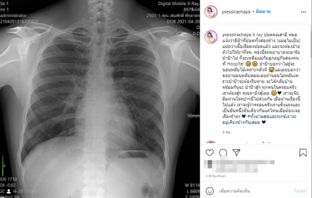 อีฟ-พุทธธิดา อัพเดตอาการอาต้อย พบรอยที่ปอดขวา แต่ไม่กระทบมะเร็ง